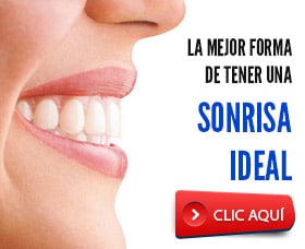 brackets invisibles arreglar dientes alinear