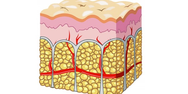 La celulitis es causada por toxinas en tu cuerpo mito