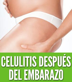 Celulitis después del embarazo durante empeora