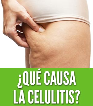 Qué causa la celulitis