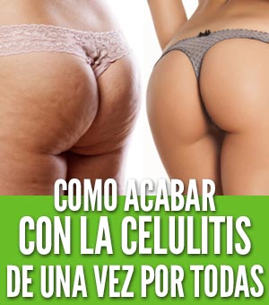 Cómo acabar con la celulitis