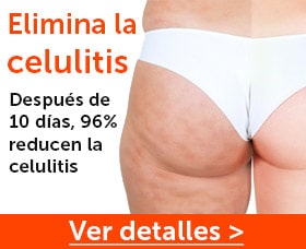 Como eliminar la celulitis rapido naturalmente