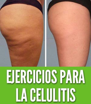 Ejercicios para la celulitis