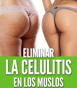 Eliminar la celulitis en los muslos