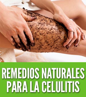 Remedios naturales para la celulitis