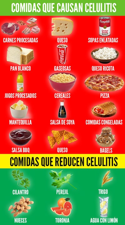 alimentos que causan celulitis comidas